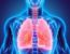 Pneumonia Aspirativa – Quais os Sintomas e Como Tratar? 